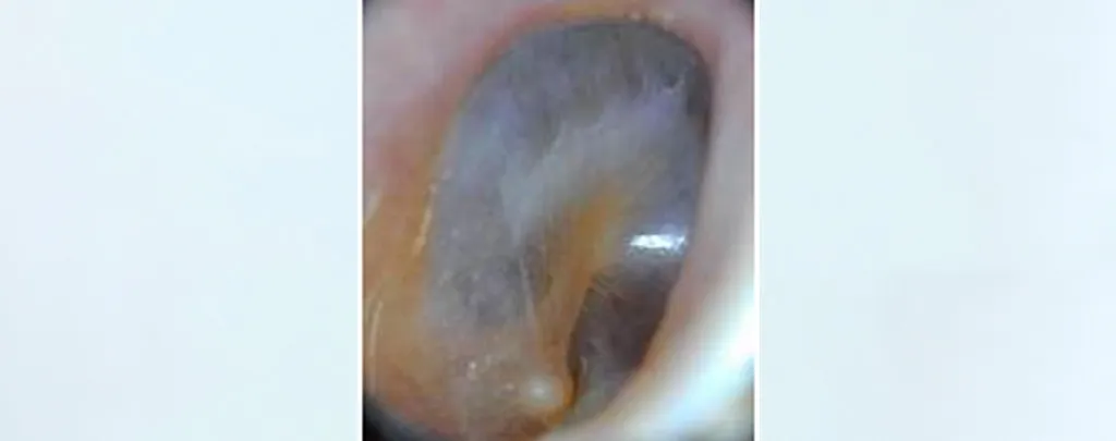 blog jan 23 - Suction Ears blog jan 23