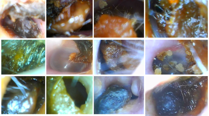 ear wax colour