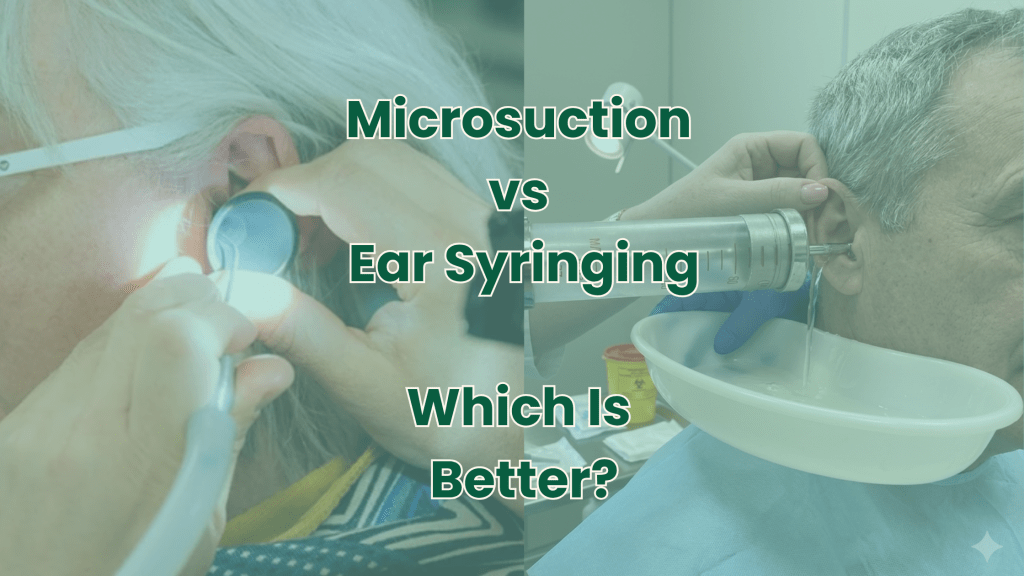 microsuction vs ear syringing